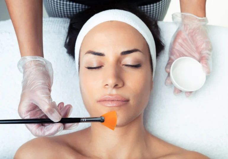 pelling su viso di donna